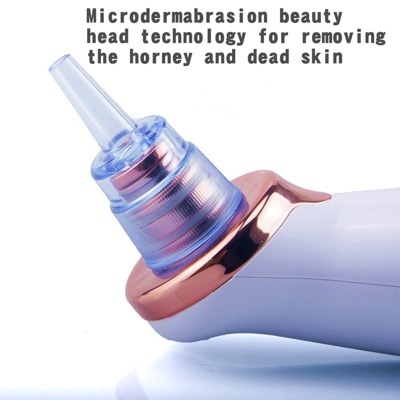 Electric Suction Blackhead Remover