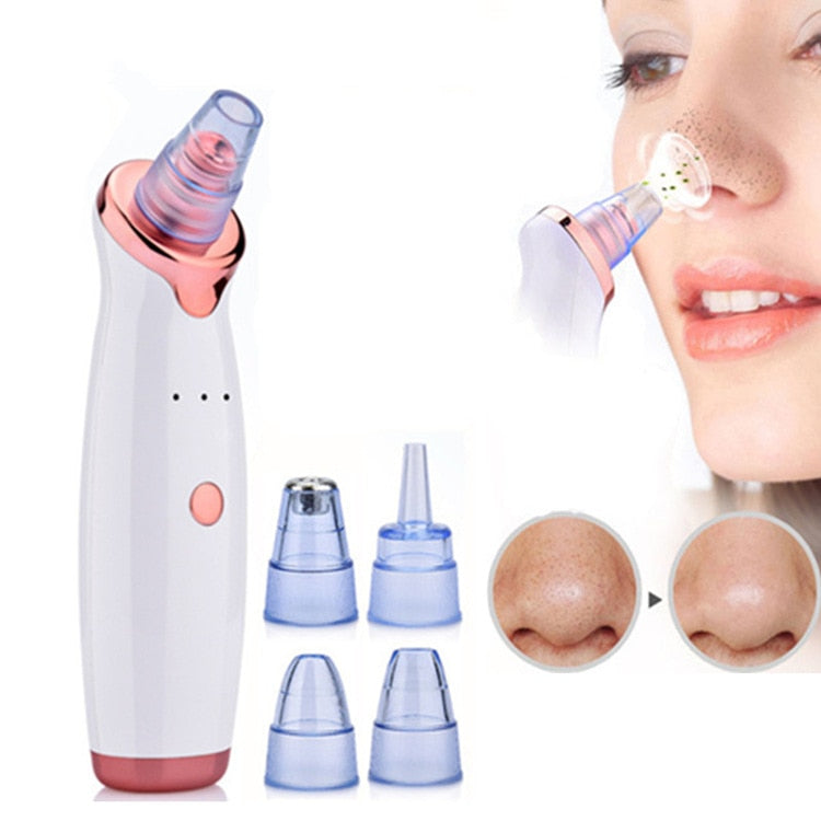 Electric Suction Blackhead Remover