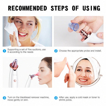 Electric Suction Blackhead Remover