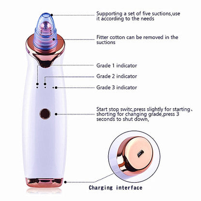 Electric Suction Blackhead Remover